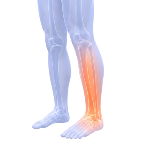 E-BOOK "Jambes légères en 7 jours
